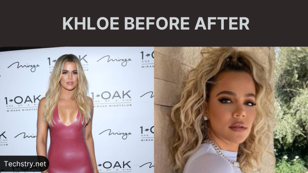 khloe before after