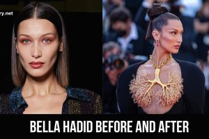 bella hadid before and after