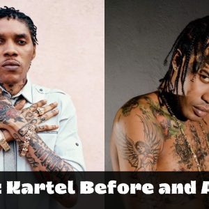 vybz kartel before and after
