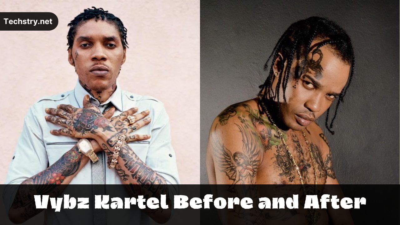 vybz kartel before and after