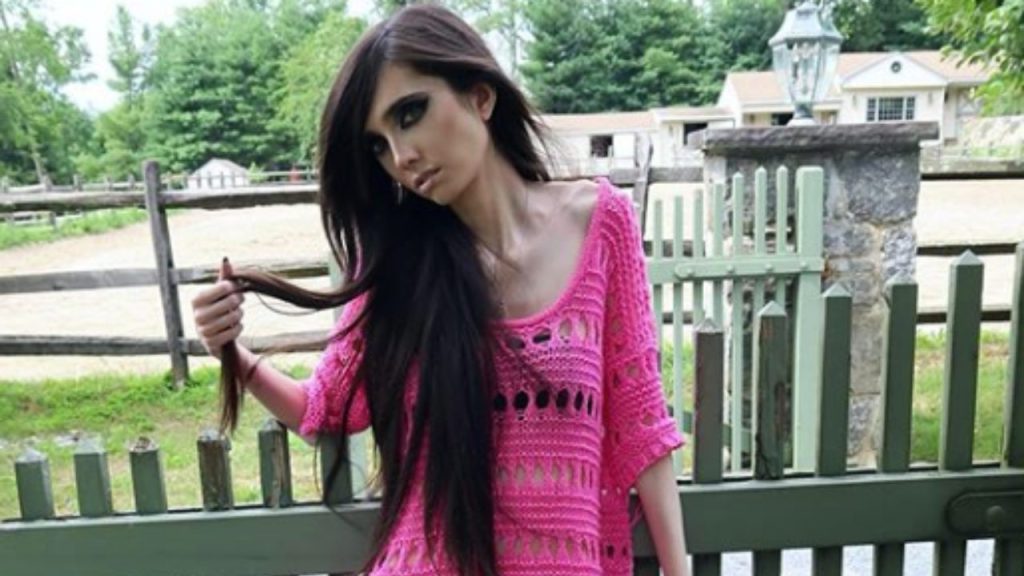 Eugenia Cooney Before and After