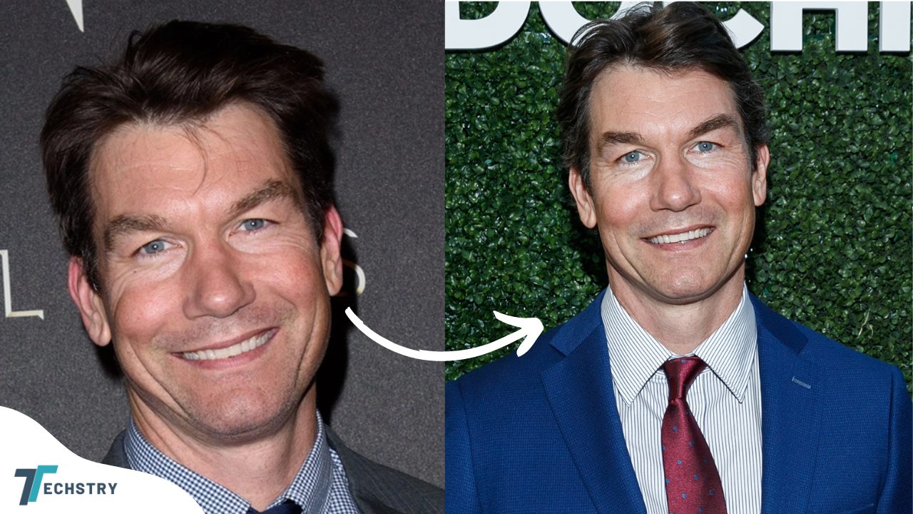 Jerry Oconnell Plastic Surgery