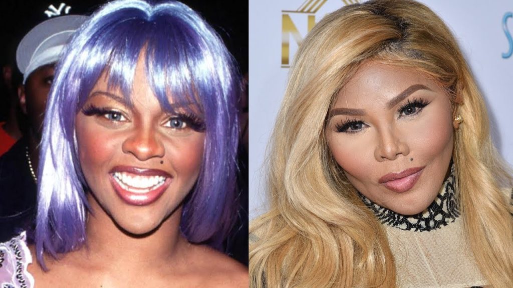 lil kim before surgery